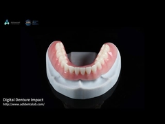 Dentadura parcial de color naranja rosa acrílico de aspecto natural Impresión 3D Dentaduras digitales