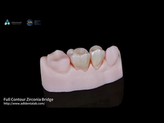 Natural de contorno completo de la corona de zirconio de ajuste preciso de contorno completo de laboratorio dental
