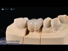 Color natural de los dientes Cerámica de carilla feldspática para dientes anteriores y posteriores
