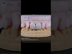 Carillas dentarias de EMAX prensadas naturales 16 tonos