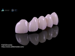 Alta translucidez de contorno completo Zirconia Puente Resistencia a las astillas Estética natural
