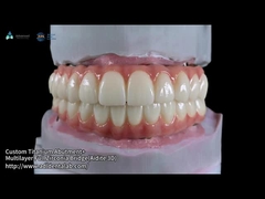 Puente de zircónia translúcido de contorno completo sobre barra de implantes fresada Diseño personalizado