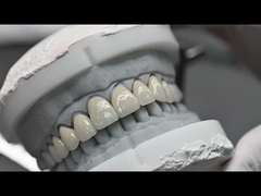 Translucidez CAD EMAX Veneer Pulida Restauración de cerámica acristalada para áreas anteriores y posteriores