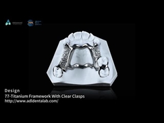 Marco de titanio impreso en 3D de alta resistencia con claves claras para un rendimiento duradero
