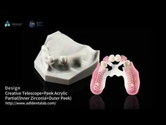 Biocompatibilidad Telescopio Dental Blanco Circónia Interior Telescopio Dental