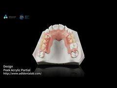 Watch: White And Pink Peek Flexible Acrylic Partial Denture With Excellent Resistance Showcase