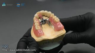 Calidad de soldadura de precisión de corona telescópica