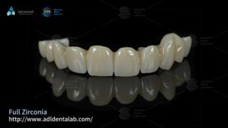 Soluciones premium de subcontratación de laboratorios dentales de circonio