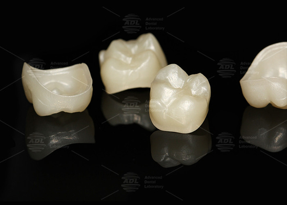 comprar Natural de contorno completo de la corona de zirconio de ajuste preciso de contorno completo de laboratorio dental Fabricación en línea