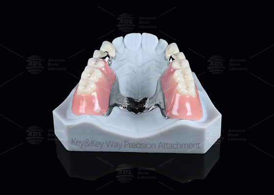 comprar Clave de plata y llavero fácil de mantenimiento Precisión de la conexión dental Fabricación en línea
