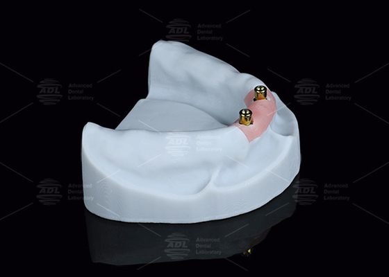 comprar Titanio Localizador Dentario para Dentaduras en Plata y Oro Finish Fabricación en línea