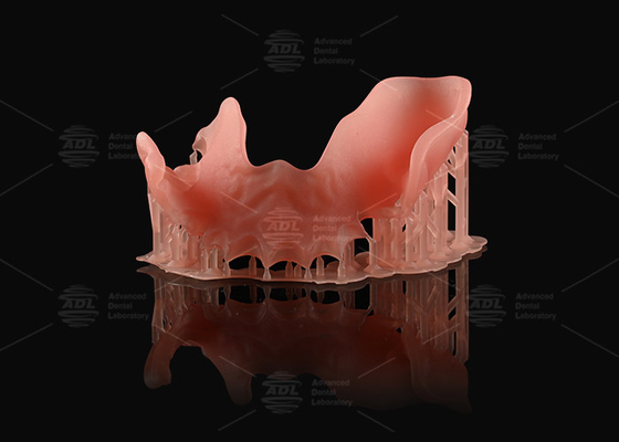 comprar Dentadura parcial de color naranja rosa acrílico de aspecto natural Impresión 3D Dentaduras digitales Fabricación en línea
