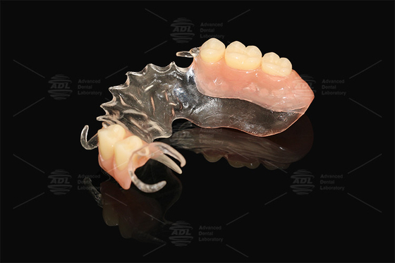 comprar Vertice clara flexible parcialmente prácticamente irrompible bajo riesgo de alergia dentadura parcial completa Fabricación en línea