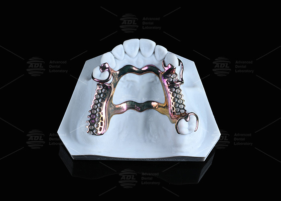 comprar Solución de marco de titanio de alta resistencia para piel sensible impresa en 3D Fabricación en línea