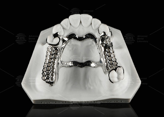 comprar Cuadro dental de metal de cobalto cromo reparable Dentadura parcial Fabricación en línea