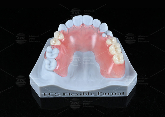 comprar TCS Flexible Resistente a manchas parcialmente libre de BPA Dentaduras parciales para un aspecto natural Fabricación en línea