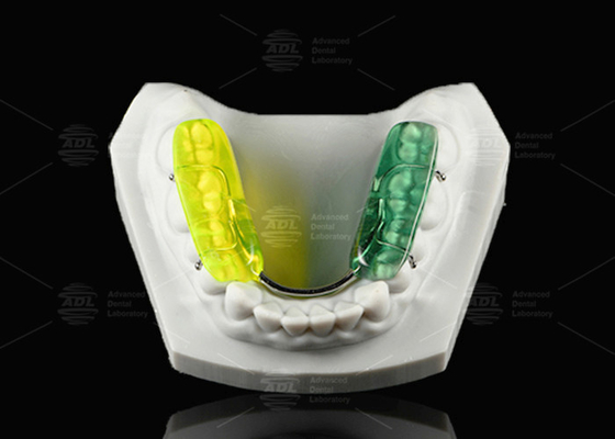 comprar Esparrillo dental de color Gelb Resina acrílica dura Esparrillo oclusal para rechinar los dientes por la noche Fabricación en línea