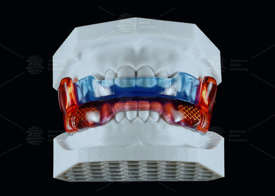 comprar Dispositivo anti ronquidos de silicona de grado médico para mejorar el sueño Fabricación en línea
