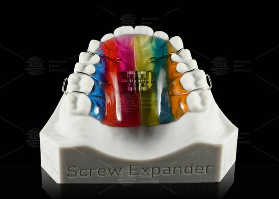 comprar Expansión y desestalización de los dientes Expansor de paladar Expansor de ortodoncia Fabricación en línea