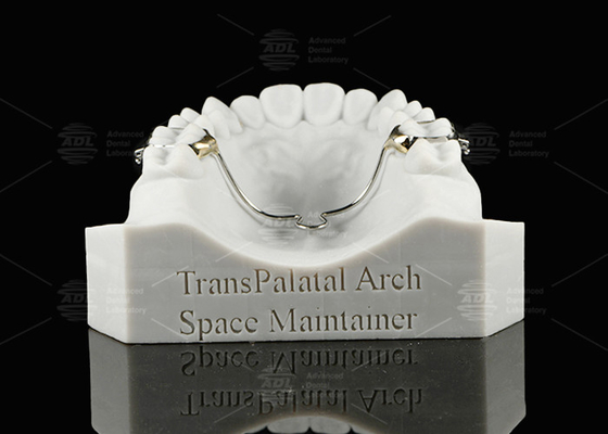 comprar ADL Arco transpalatal mantenedor de espacio Arco de mantenimiento de espacio extraíble Fabricación en línea