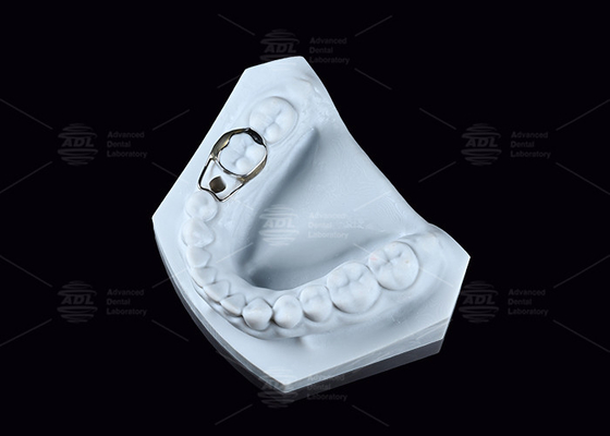 comprar SS mantenedor de espacio pediátrico confortable mantenedor de espacio dental higiénico Fabricación en línea