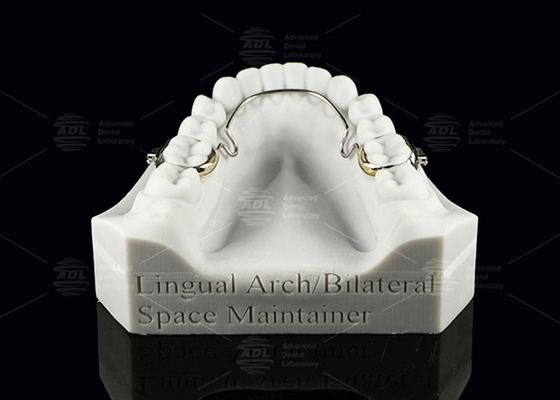 comprar Arco Lingual Mantenedor de espacio bilateral Dientes de acero inoxidable Mantenedores de espacio Fabricación en línea