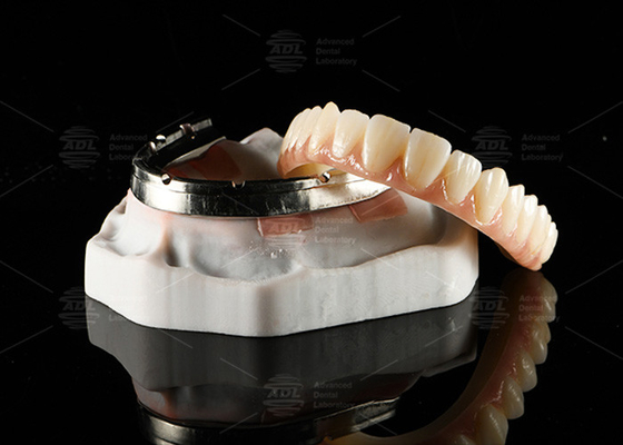 comprar Puente de zircónia translúcido de contorno completo sobre barra de implantes fresada Diseño personalizado Fabricación en línea