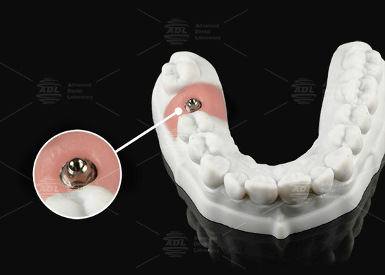 comprar Abutment de Titanio de Oro de Plata de Unidad Múltiple para Plataforma Protética de Unidad Única o Múltiple Fabricación en línea