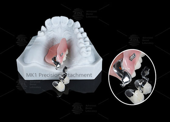 comprar MK1 Prótesis dental de adherencia Prótesis dental parcial de plata Adherencias de precisión Fabricación en línea