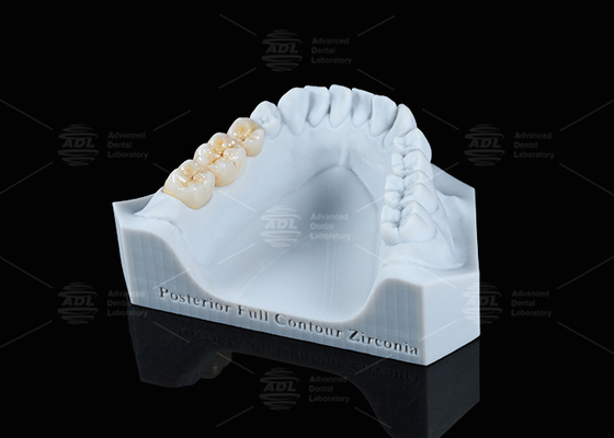 comprar Translucidez Blanco de contorno completo Corona de zirconio FCZ Corona de zirconio monolítica Fresado fácil Fabricación en línea