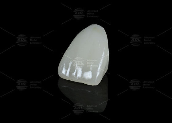 comprar Laboratorio Dental de China Híbrido Cerámico Vita Dental Enámico con Translucidez para Restauraciones de Dientes Únicos Fabricación en línea