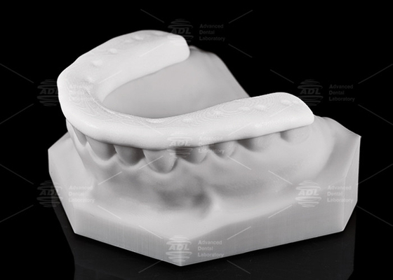 comprar Durabilidad y transpirabilidad 3D Impreso de Nylon Oclusal Splint / Guardia nocturna para estilos de vida activos Fabricación en línea