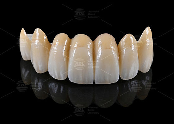 comprar Laboratorio Dental de China que proporciona materiales de bloque de AIDITE ZIRCONIA junto con tiempo de respuesta en 72 horas para la fabricación dental Fabricación en línea