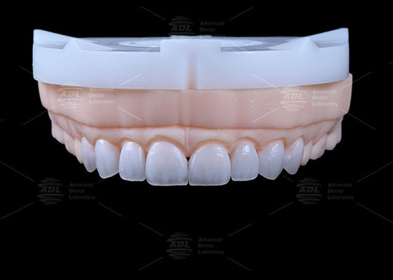 comprar Laboratorio Dental de China Más de 13 años en la industria del laboratorio dental proporcionando carilla Emax de 16 tonos para satisfacer las diversas necesidades de restauración dental Fabricación en línea