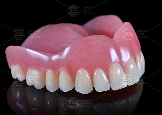 comprar Laboratorio Dental de China Alta Estética Personalizada Dentadura Plena Acrílica Servicio completo para todo el mundo Fabricación en línea