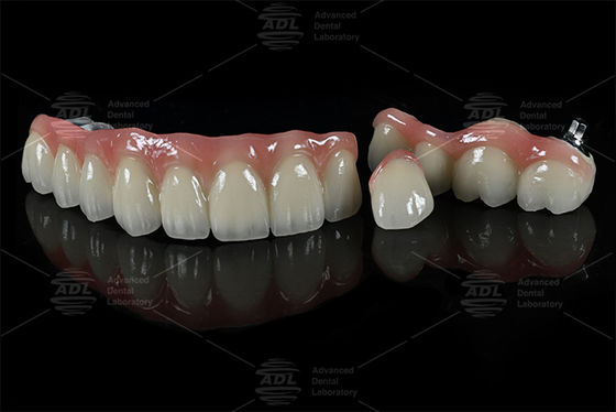 comprar Soluciones dentales PFZ hipoalergénicas diseñadas para satisfacer diversas necesidades clínicas y de laboratorio dental, garantizando la precisión Fabricación en línea
