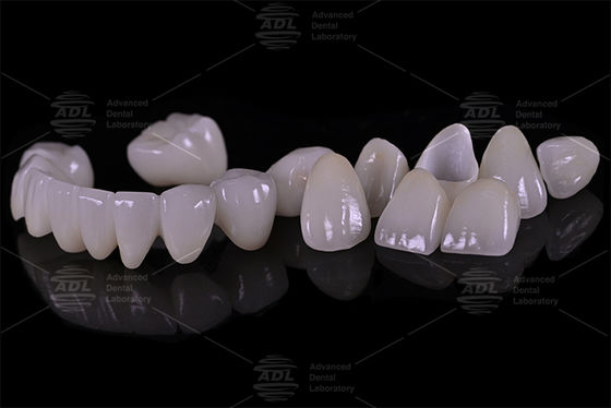 comprar Porcelana de laboratorio dental de China fusionada con zirconio de alta resistencia proporcionando servicios personalizados a laboratorio dental internacional y dentista Fabricación en línea