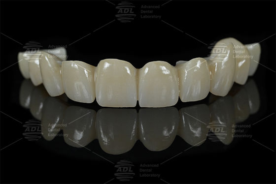 comprar Laboratorio dental de China con restauraciones dentales de zirconio completo Laboratorio dental especializado en materiales AIDITE ZIRCONIA BLOCK para soluciones dentales duraderas Fabricación en línea