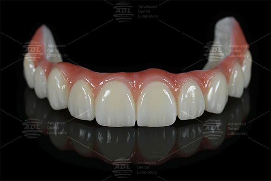 comprar China Dental Lab Titanio Y Zirconia Todo en X en 16 tonos incluyendo A1 A2 A3 de laboratorio dental para estética dental natural Fabricación en línea