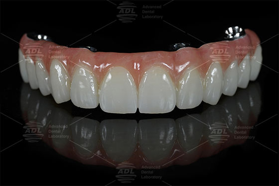 comprar Laboratorio dental de China Rápido tiempo de respuesta en 72 horas proporciona alta calidad todo en X Fabricación en línea