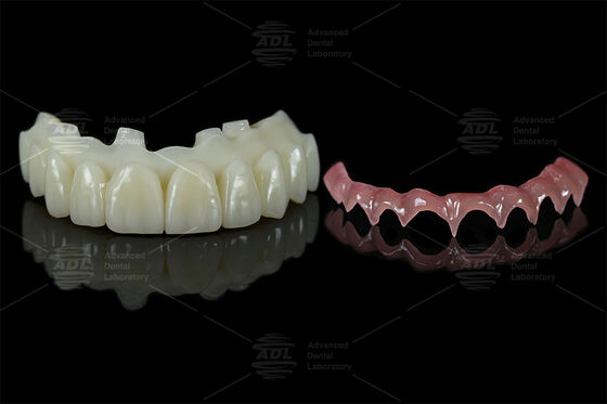 comprar Barra de apoyo de implantes impresos en 3D para tratar de fijar directamente de todo en X desde el laboratorio dental chino Fabricación en línea