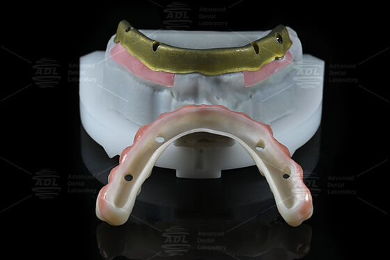 comprar Laboratorio Dental de China Compatible con la mayoría de los sistemas de implantes dentales Todos en 4 Ofreciendo en 72 horas Tiempo de respuesta y parámetros técnicos Fabricación en línea