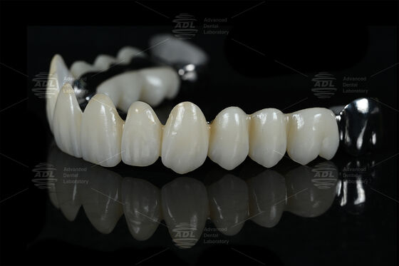 comprar China Dental Lab subcontrata la barra de refuerzo de laboratorio dental Ti con zirconio completo que ofrece precios competitivos con descuentos de volumen adaptados a los profesionales dentales que requieren y fabrican Fabricación en línea