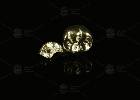 Oro de aleación preciosa amarillo 60% Corona de metal completo Oro acabado Corona de metal completo