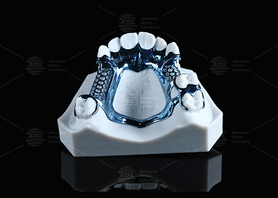 Marco de titanio anodizado impreso en 3D ligero y adecuado para piel sensible