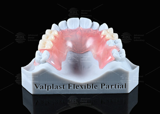Apariencia natural Valplast Dentadura parcial Durabilidad muy resistente a las fracturas