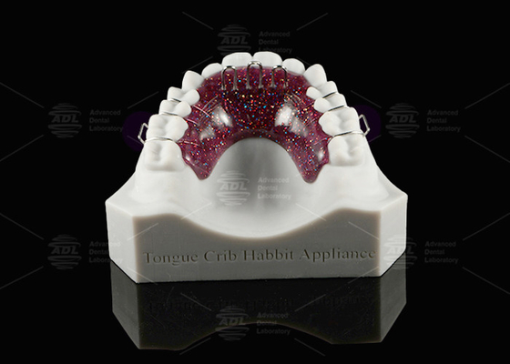 Dispositivo de cuna de lengua ortodóntica Habbit Dispositivo de cuna dental personalizable