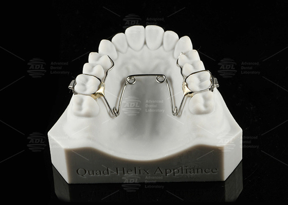 Niños y adolescentes Quad Helix Aplicación Ortodoncia Acero inoxidable