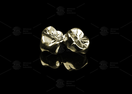 Coronilla de metal fundido elegante de aleación de oro 20% de oro pulido de corona dental de metal completo