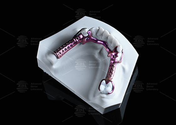 Marco de titanio 3D anodizado de alta resistencia y ligero y ajustable